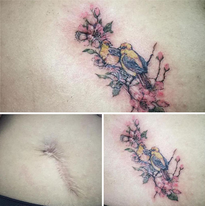 Tattoo covers scar with floral and bird design by artist.