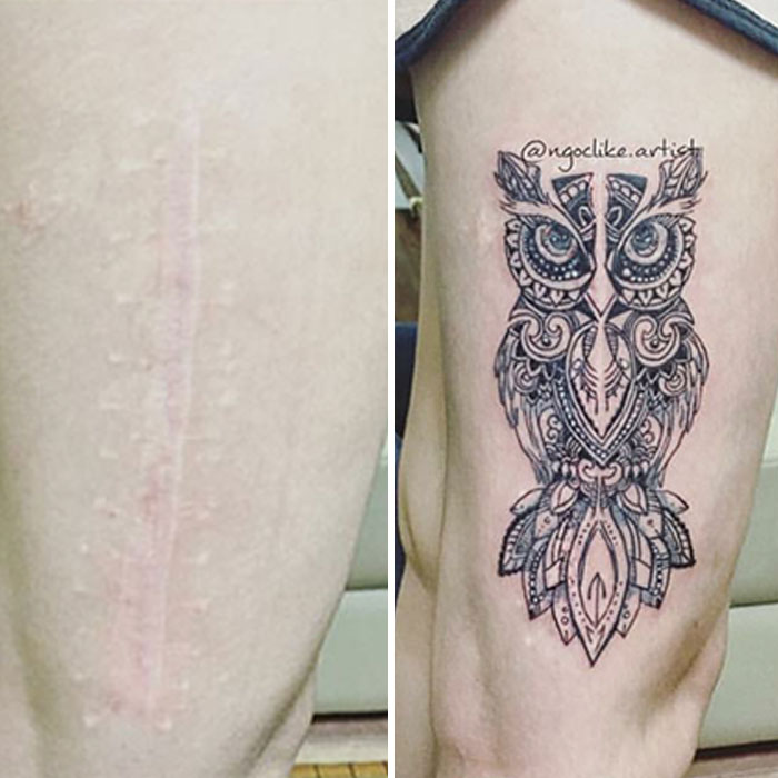 Tattoo covers scar with detailed owl design by a talented artist.