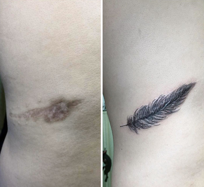 Tattoo artist covers scar with a feather tattoo, transforming and enhancing the skin artfully.