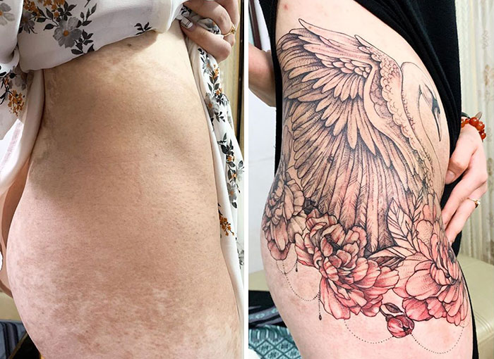 Tattoo artist covers scars with intricate swan and floral design.