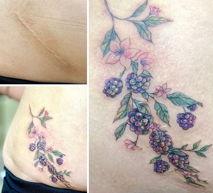 Tattoo artist covers a scar with a floral and berry design.