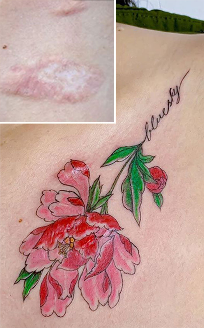 Tattoo Artist Makes Real Works Of Art Covering Sad Scars