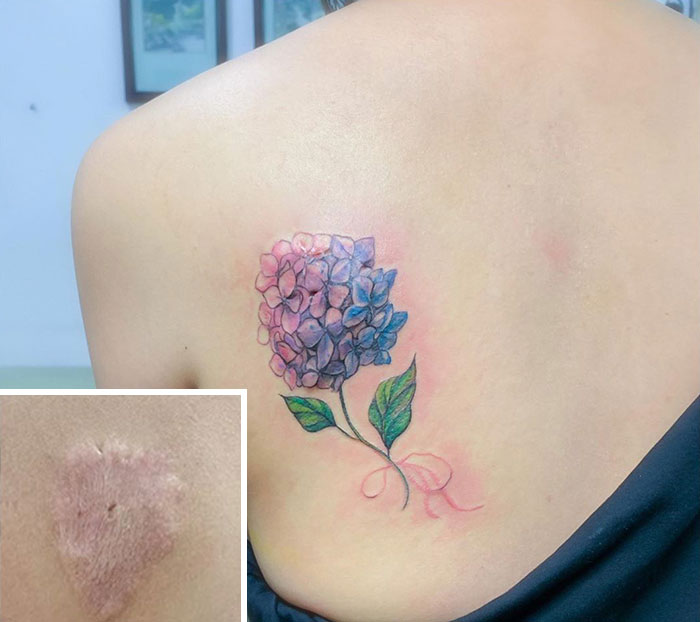 Floral tattoo covering a scar on the shoulder, showcasing expert tattoo artistry.