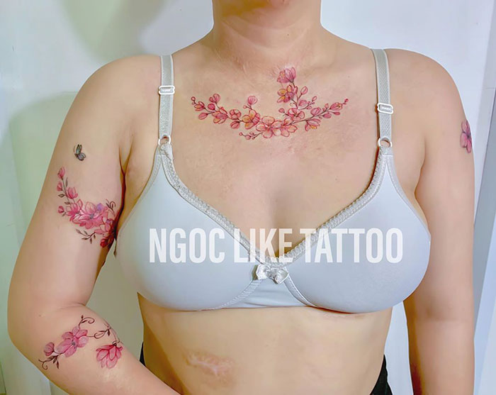 Tattoo artist covers scars with floral designs on a woman's arms and chest.