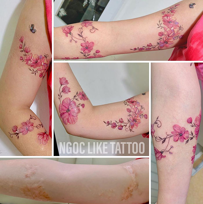 Floral tattoos beautifully cover arm scars, showcasing a tattoo artist's skill in scar camouflage.