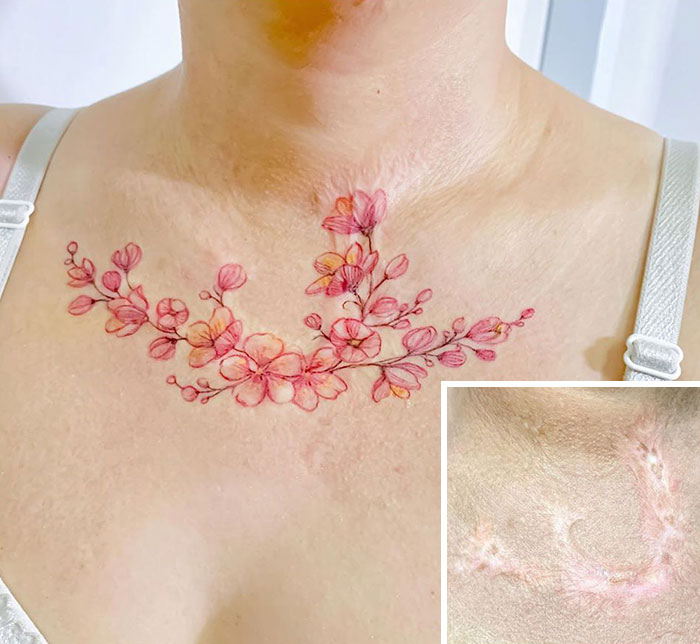 Tattoo artist covers scars with floral design on chest, highlighting transformation.