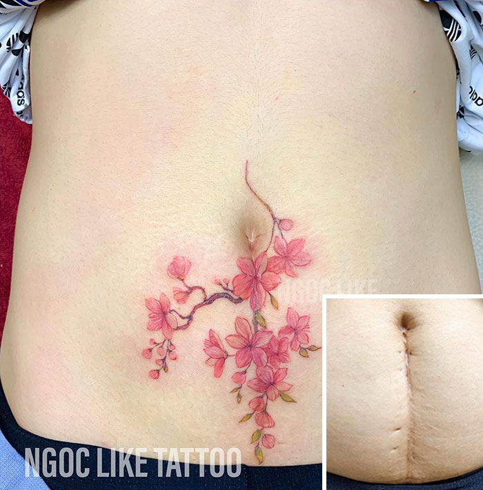 Cherry blossom tattoo covering a scar on the abdomen.