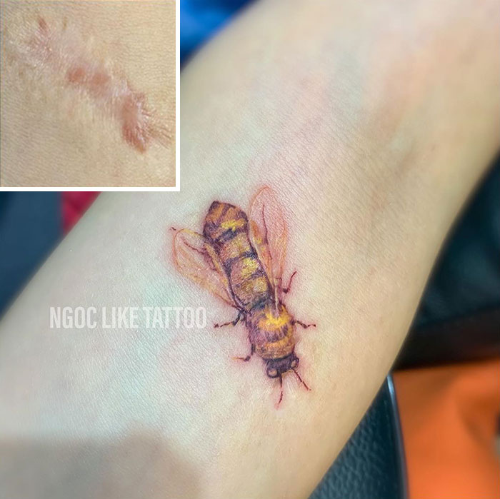 Tattoo artist covers arm scar with a detailed bee tattoo.