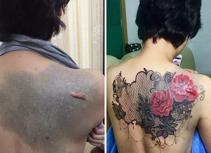 Tattoo artist covers scar on a person's back with floral design.