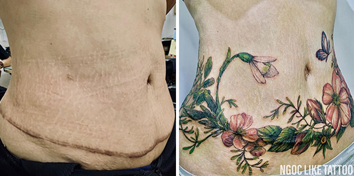 Tattoo covers scar with floral design, before and after transformation.