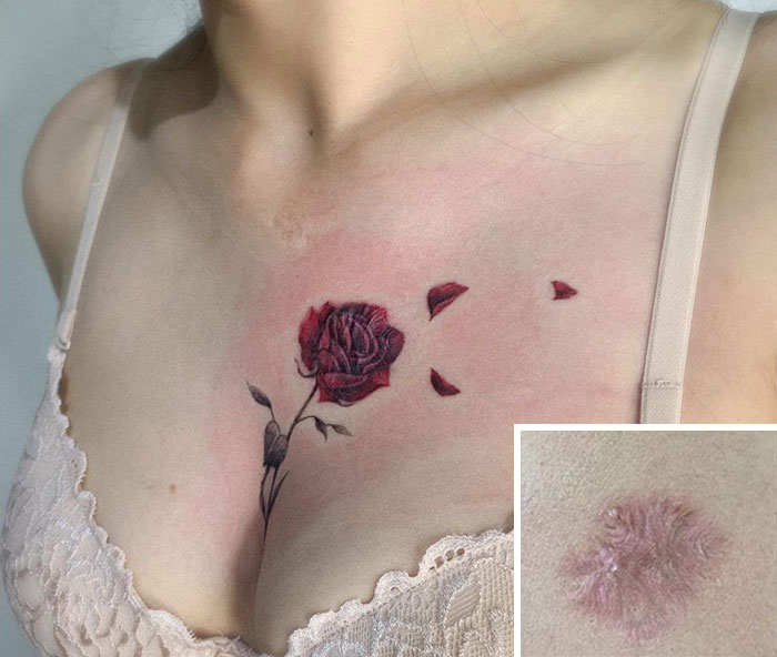 Tattoo artist covers a scar on a woman's chest with a red rose tattoo.