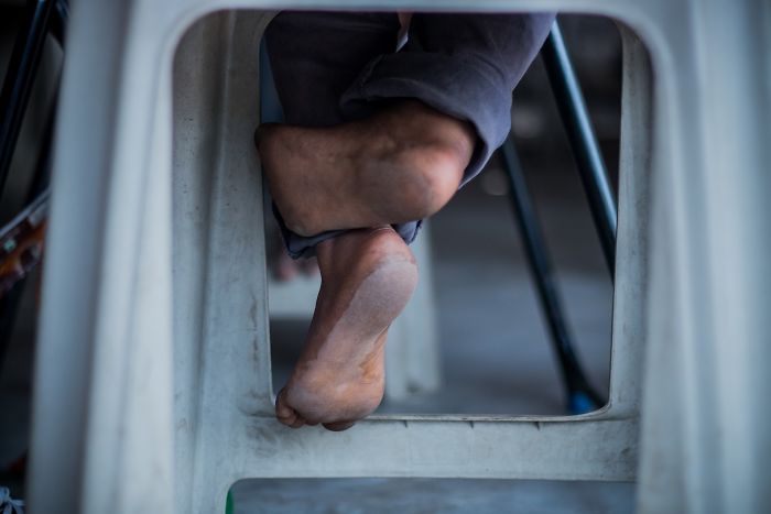 Close-up of bare feet crossed under a plastic chair, illustrating what made employers reject job candidates.