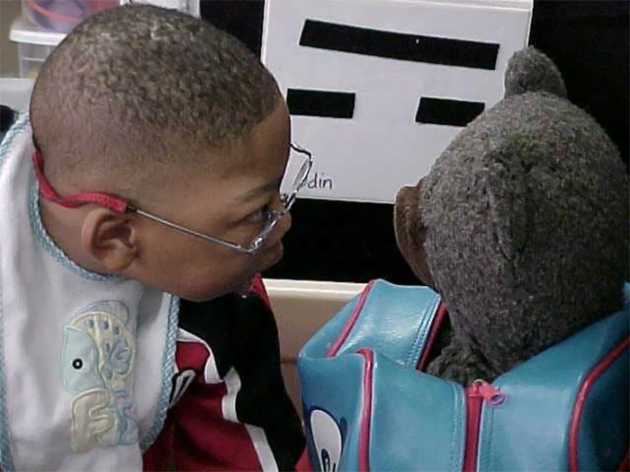 Best Friends Given 2% Chance Of Survival Beat All Odds And Recreate Their First School Photo At Their Graduation