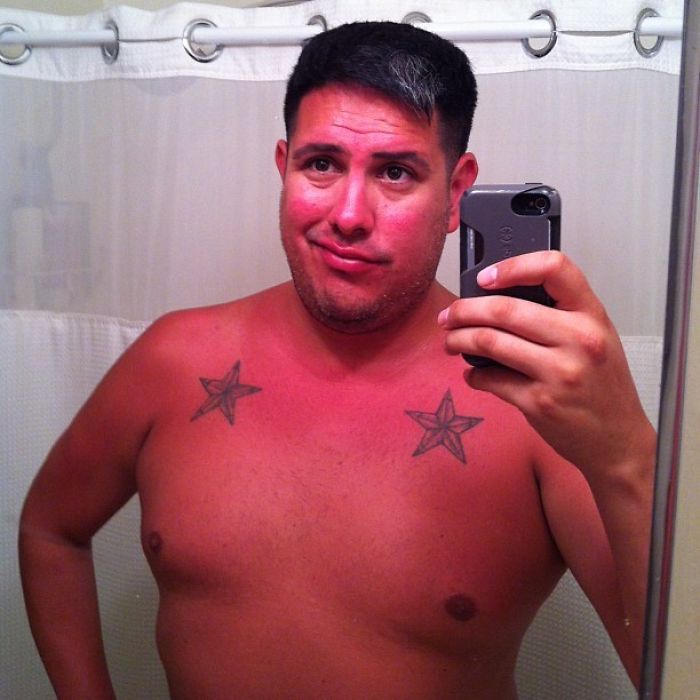 My First Bathroom Selfie. Because I May Be A Little Sunburn