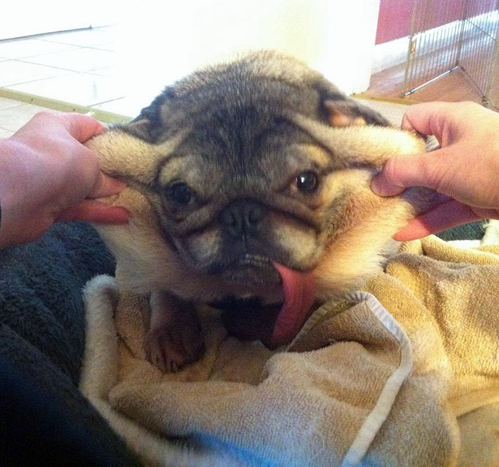 Look At All My Extra Skin In My Cheeks From My Dramatic Weight Loss