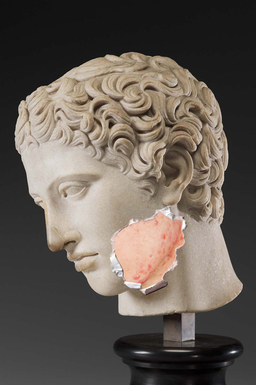 Artist Shares Body-Positive Message Through Greek Statues