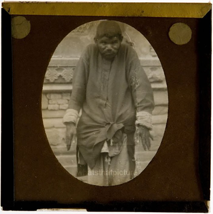 Dina Sanichar, The Real-Life Mowgli Who Grew Up With The Wolves