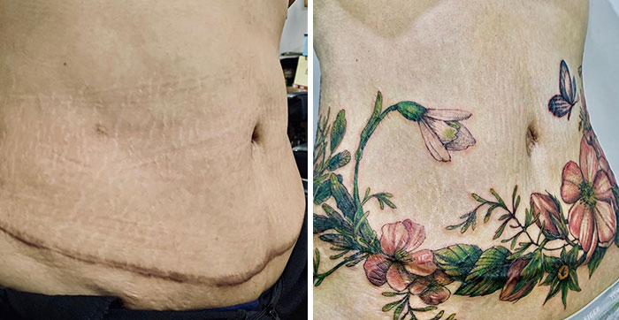 30 Times People Asked To Cover Up Their Scars, And This Tattoo Artist Nailed It