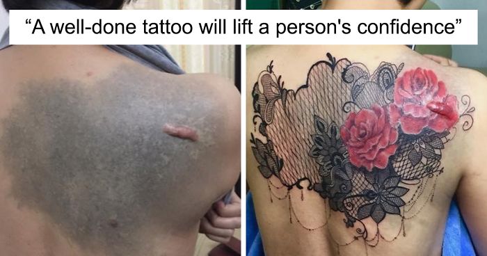 30 Times People Asked To Cover Up Their Scars, And This Tattoo Artist Nailed It