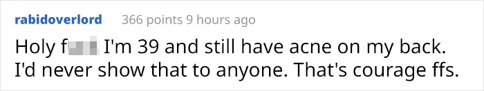 'I'm Sure I'd Feel The Same Way If I Was A Skinny White Girl': Person Attacks A Girl With Acne, Gets Put In Their Place Immediately 'I'm Sure I'd Feel The Same Way If I Was A Skinny White Girl': Person Attacks A Girl With Acne, Gets Put In Their Place Immediately