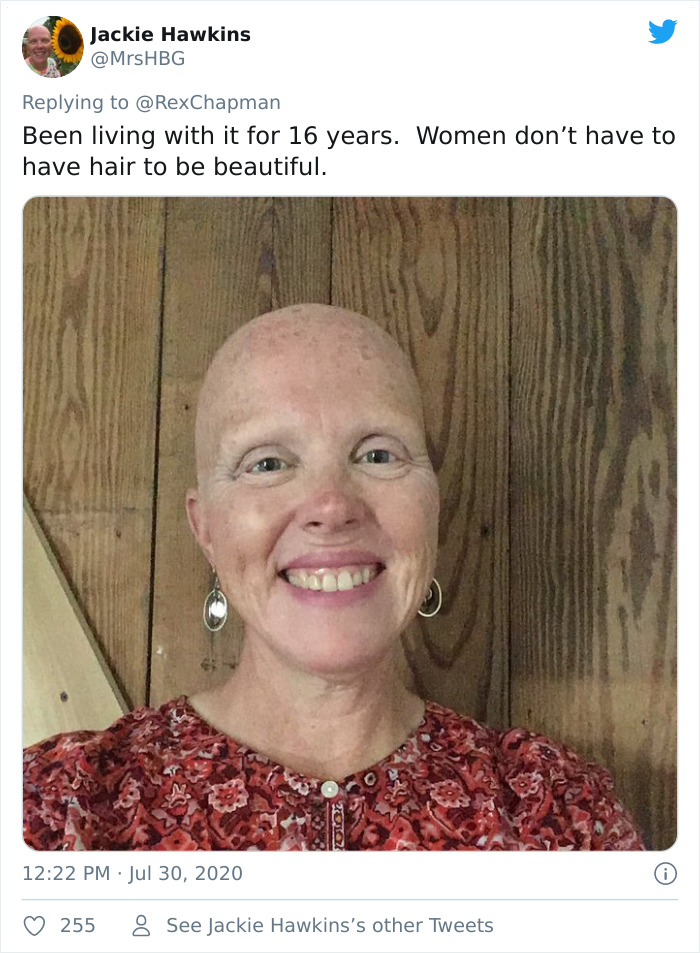 Boyfriend Shaves Girlfriend's Head Due To Alopecia Only To Shave His Own Immediately Boyfriend Shaves Girlfriend's Head Due To Alopecia Only To Shave His Own Immediately
