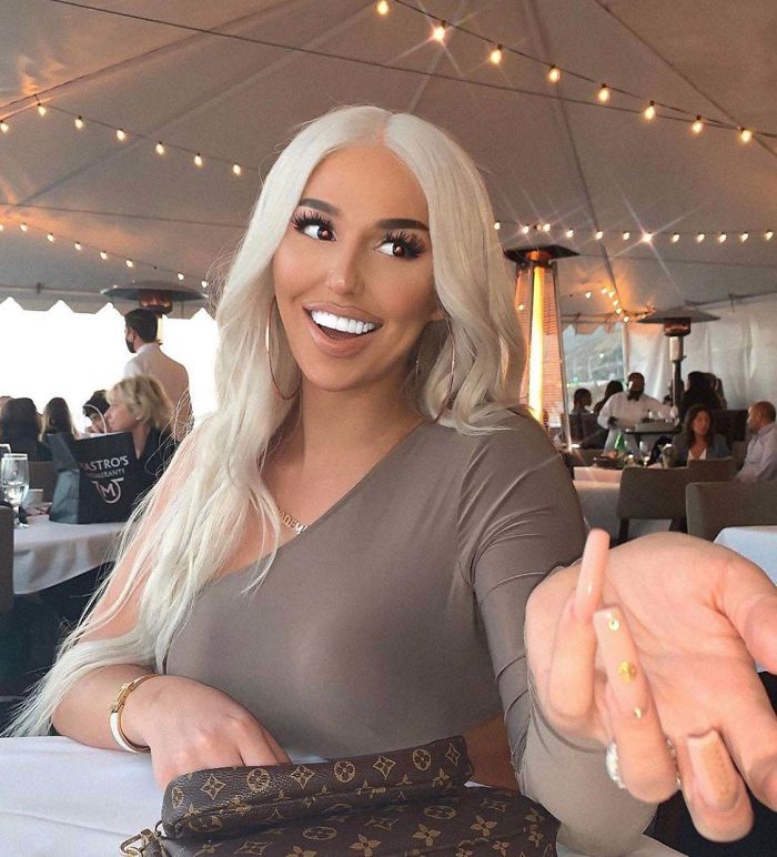 When Your Teeth And Sclera Are The Same Pearly White Color