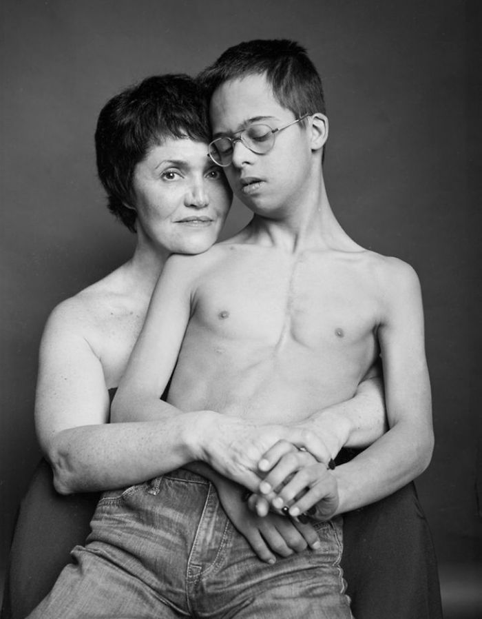 Mom Tanya And Son Lev, 15 Years Old, Down Syndrome