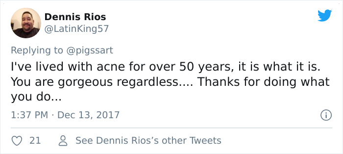 'I'm Sure I'd Feel The Same Way If I Was A Skinny White Girl': Person Attacks A Girl With Acne, Gets Put In Their Place Immediately 'I'm Sure I'd Feel The Same Way If I Was A Skinny White Girl': Person Attacks A Girl With Acne, Gets Put In Their Place Immediately