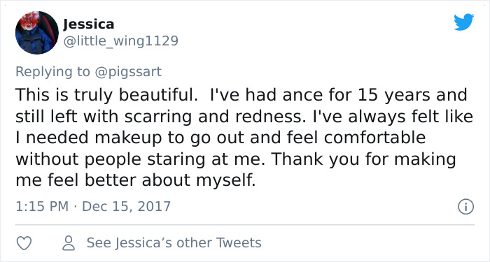 'I'm Sure I'd Feel The Same Way If I Was A Skinny White Girl': Person Attacks A Girl With Acne, Gets Put In Their Place Immediately 'I'm Sure I'd Feel The Same Way If I Was A Skinny White Girl': Person Attacks A Girl With Acne, Gets Put In Their Place Immediately