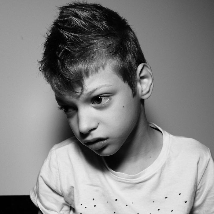 Danilo, 9 Years Old. Mother Natalia, 38 Years Old. Diagnosis: Cerebral Palsy, Epilepsy, Partial Atrophy Of The Optic Nerve