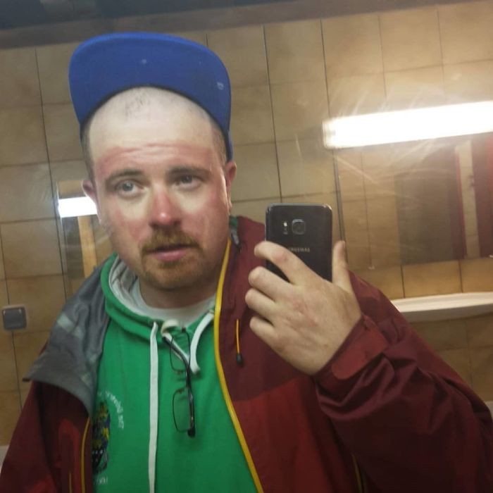 "What Was The Biggest Mistake You Made In The Alps, Tim?" Suncream, Sunglasses, Spare Sunglasses