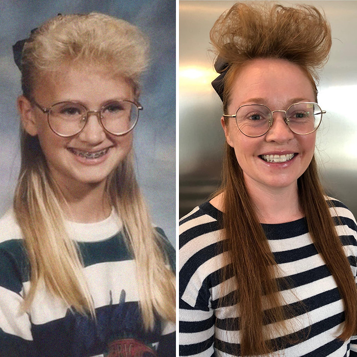 Built-In Airbags To Protect My Amazing Forehead