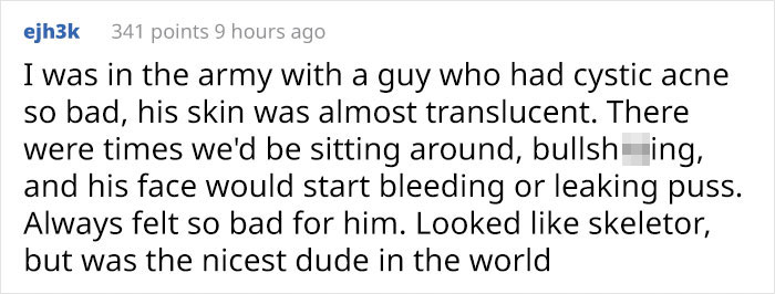 'I'm Sure I'd Feel The Same Way If I Was A Skinny White Girl': Person Attacks A Girl With Acne, Gets Put In Their Place Immediately 'I'm Sure I'd Feel The Same Way If I Was A Skinny White Girl': Person Attacks A Girl With Acne, Gets Put In Their Place Immediately