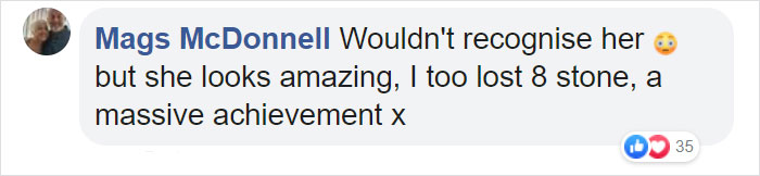 Adele Lost 98 Pounds And When People Say She's Unrecognizable, They Aren't Lying Adele Lost 98 Pounds And When People Say She's Unrecognizable, They Aren't Lying