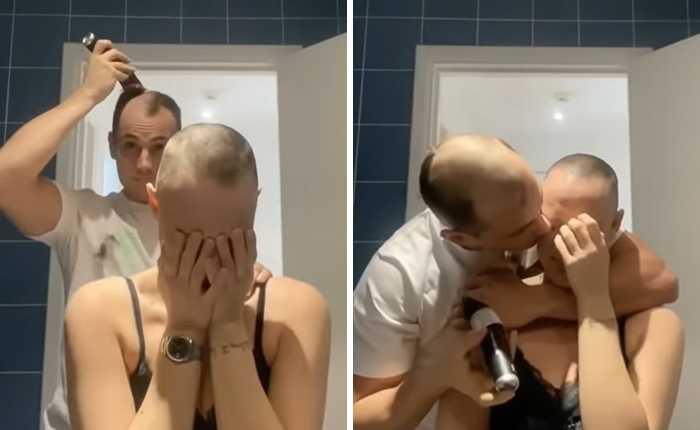 Boyfriend Shaves Girlfriend's Head Due To Alopecia Only To Shave His O...