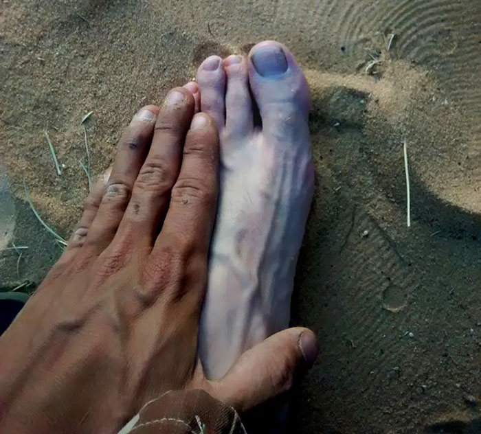 The Tan Of My Hand Compared To My Foot