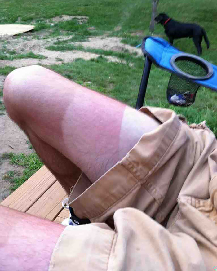 Tried Evening Out My Tan From The Other Day, Didn't Go So Well