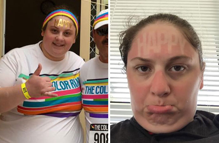 Not "Happy". Forgot Sunscreen On My Face, And Am Waiting For An X-Ray For A Rolled Ankle. Not Happy Jan. And Not So Fun Color Run