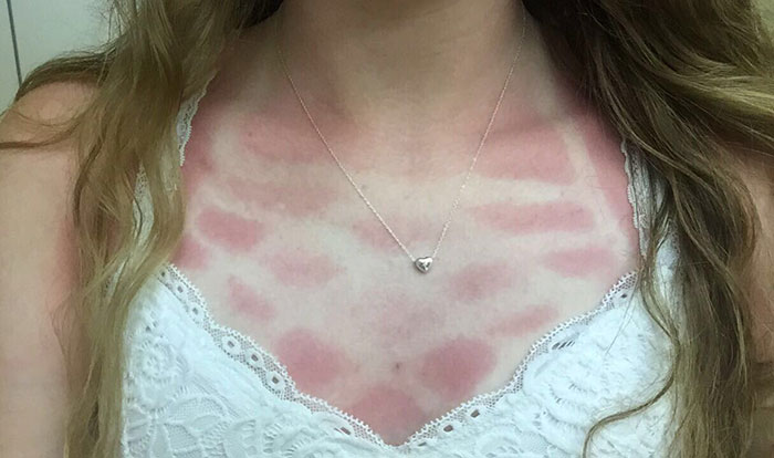 To All Bathing Suit Shoppers - Always Keep Tan (& Burn) Lines In Mind