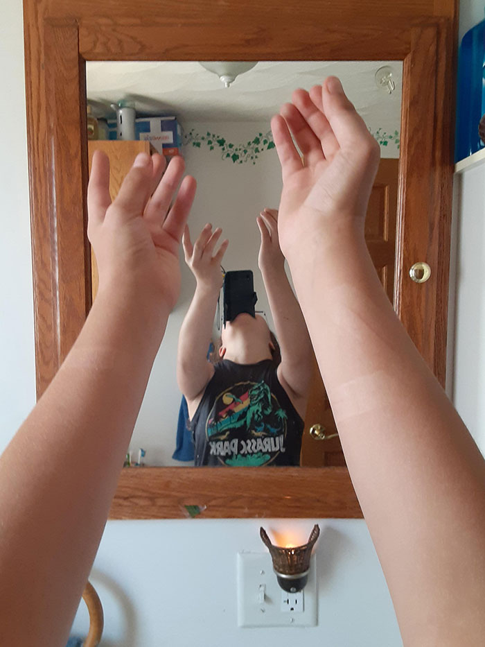 I Got Band-Aid Tan Lines