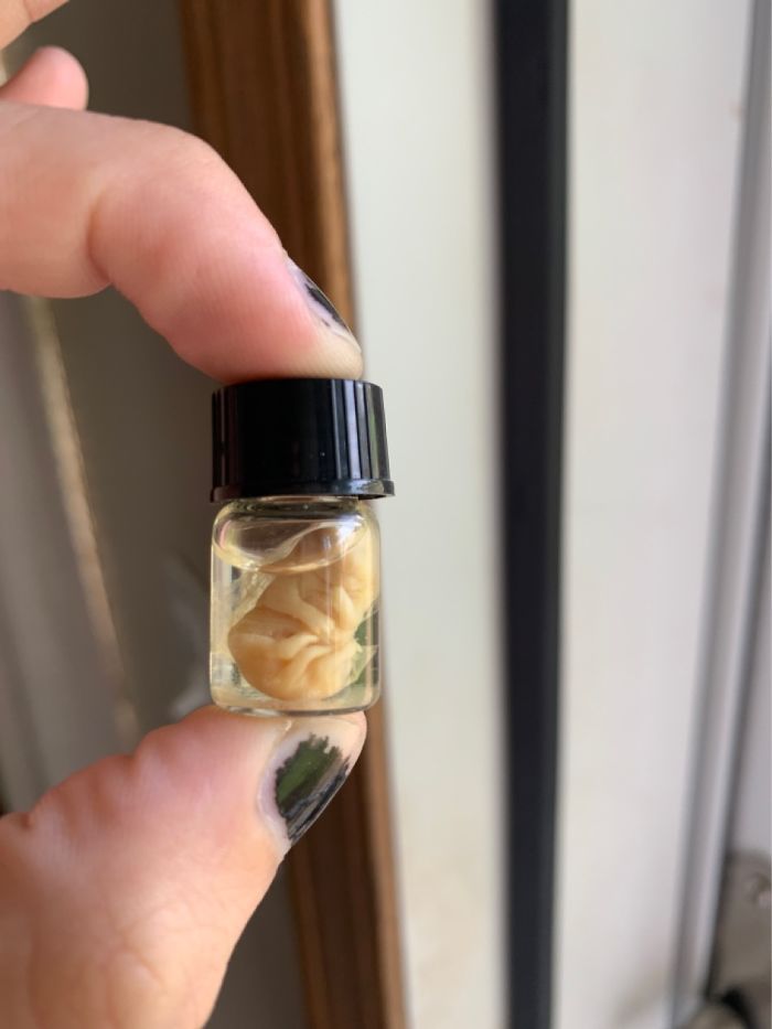 Mouse Fetus, Do I Win?