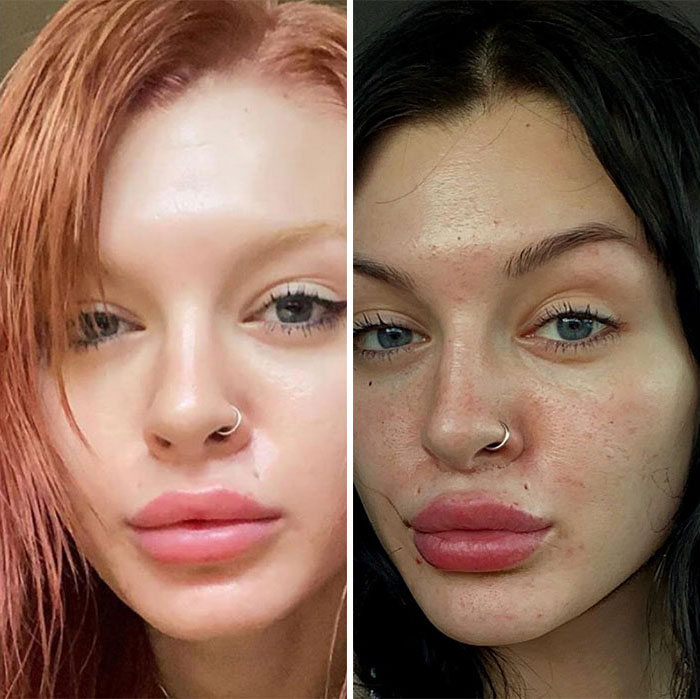 Natural Glow vs. “Natural Glow”