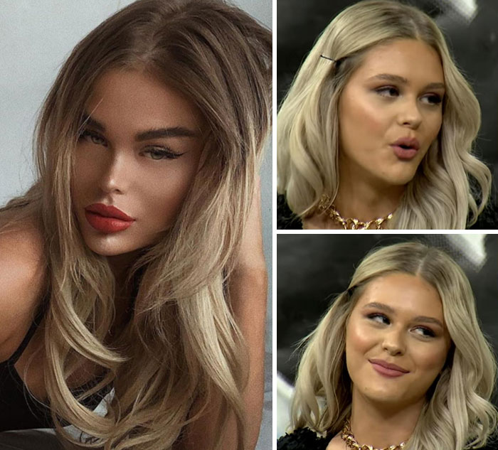 According To Her Bio, "Social Media Seriously Harms Your Mental Health"