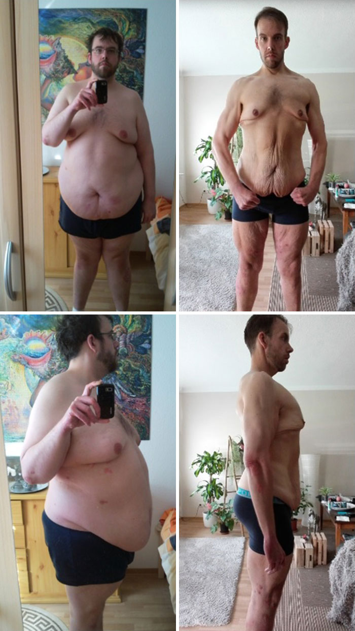 I've Lost 129 Kg/284 Lbs And Now Weigh Less Than 100 Kg For The First Time In My Adult Life