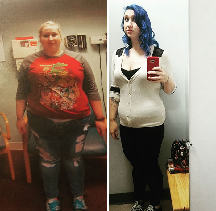 In Case You Are Overweight And Considering Bariatric Surgery Or Just Need Some Motivation Here Is My Story