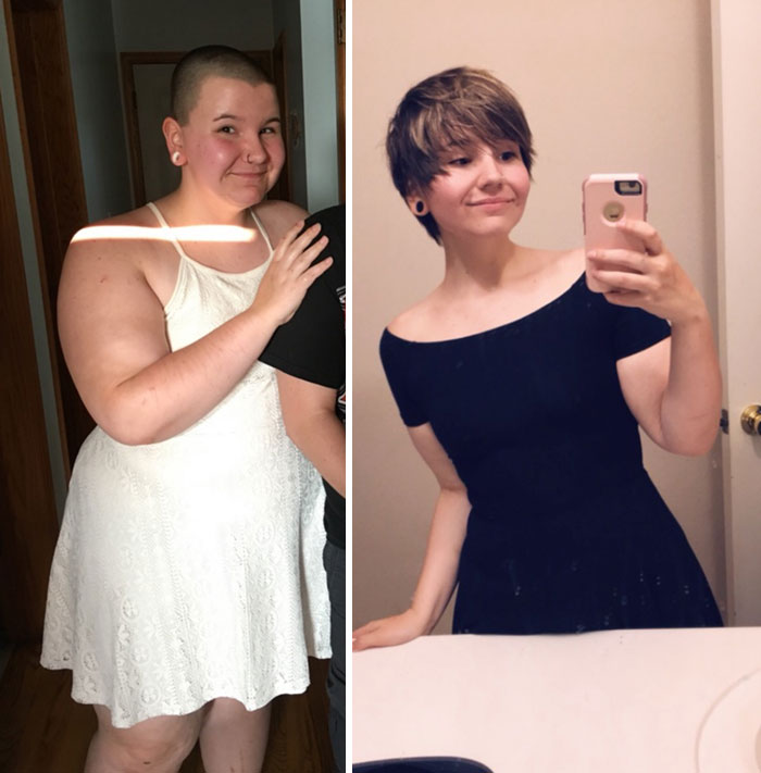 300 Lbs > 164 Lbs = 136 Lbs. Weight Loss Progress