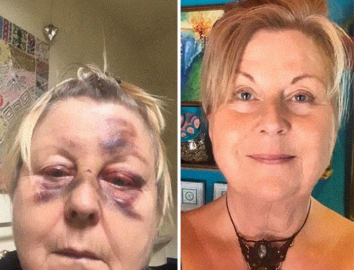 Trasformation-Stories-Before-After-The-Addicts-Diary