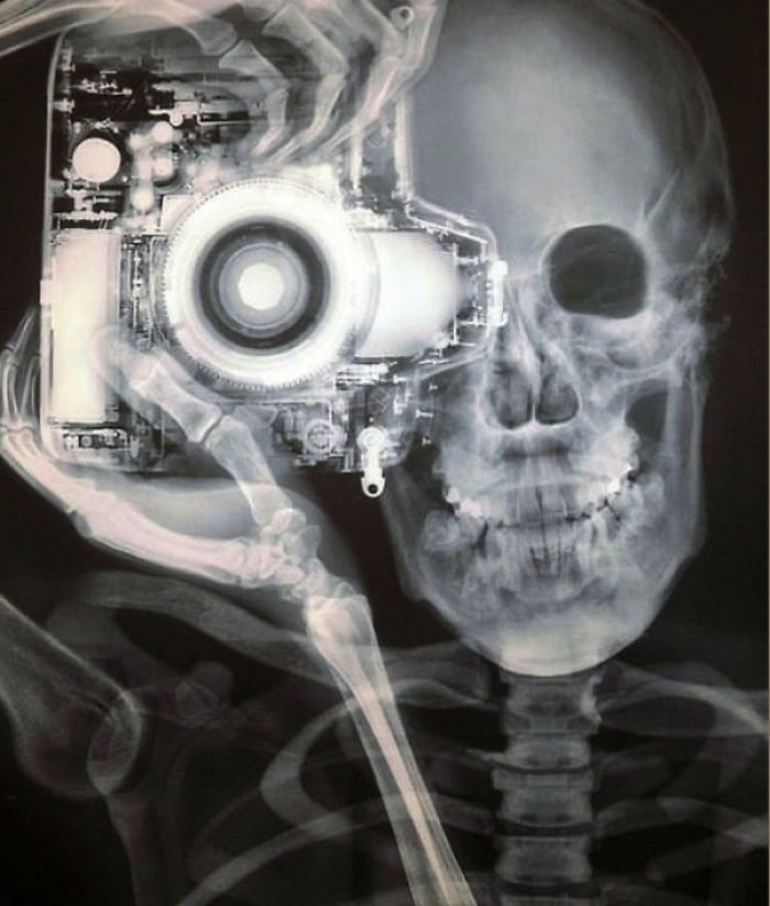 X-Ray Of A Photographer And Camera