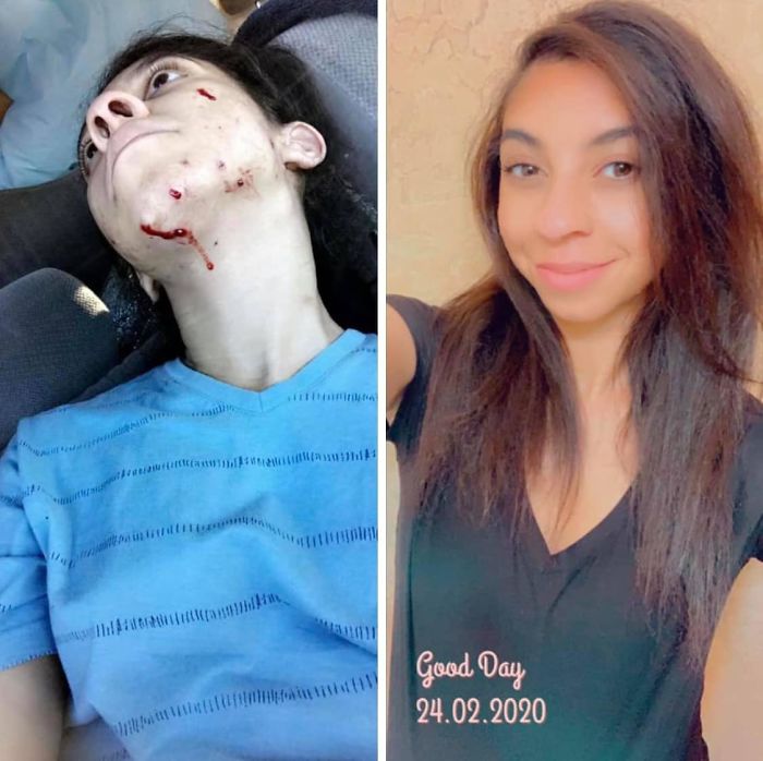 Trasformation-Stories-Before-After-The-Addicts-Diary