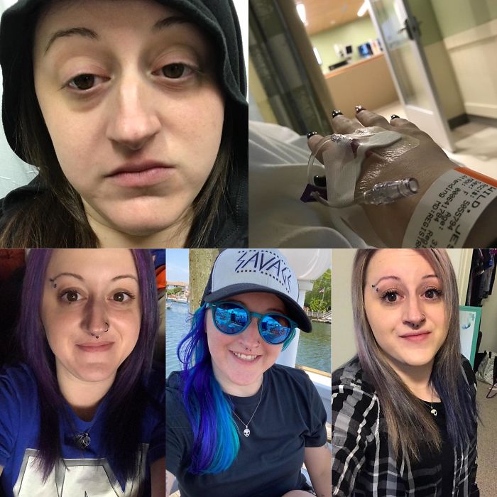 Trasformation-Stories-Before-After-The-Addicts-Diary